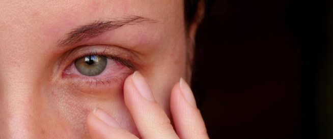 الاعراض التي تظهر في من تصيبه التهابات في قرنية العين